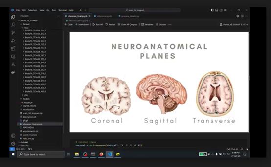 3D Brain Tumor Segmentation